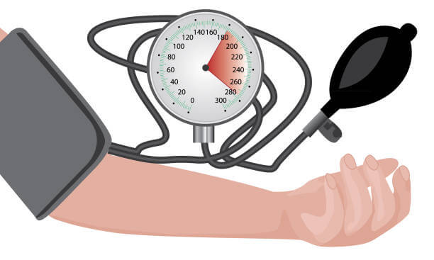 Importancia de una medición precisa de la presión arterial